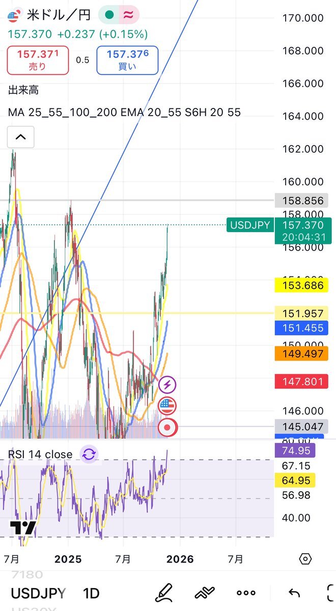 円安進行、157円台突破で海外旅行費増加懸念
