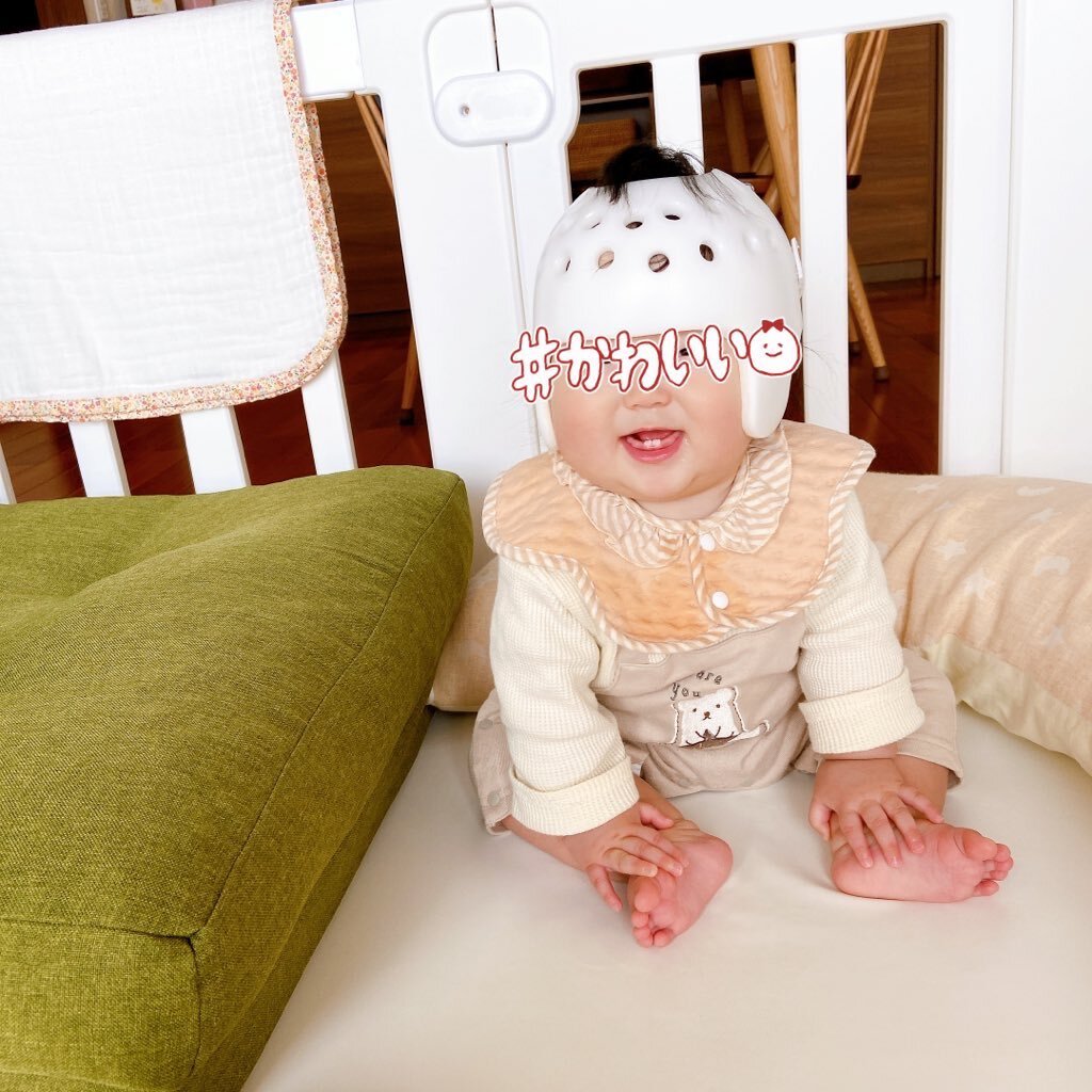 ヘルメット治療：SNSで話題に、保険適用化の声も