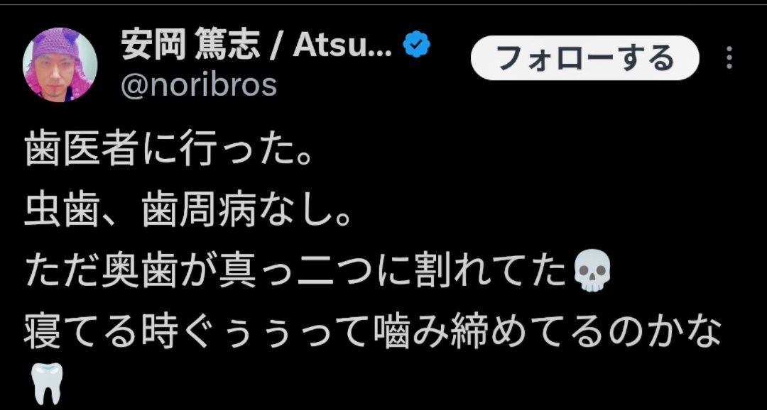 ロッテ チョコパイに歯混入、原因究明へ