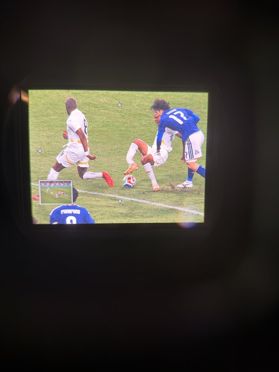 ガーナの選手、深刻な怪我で病院へ