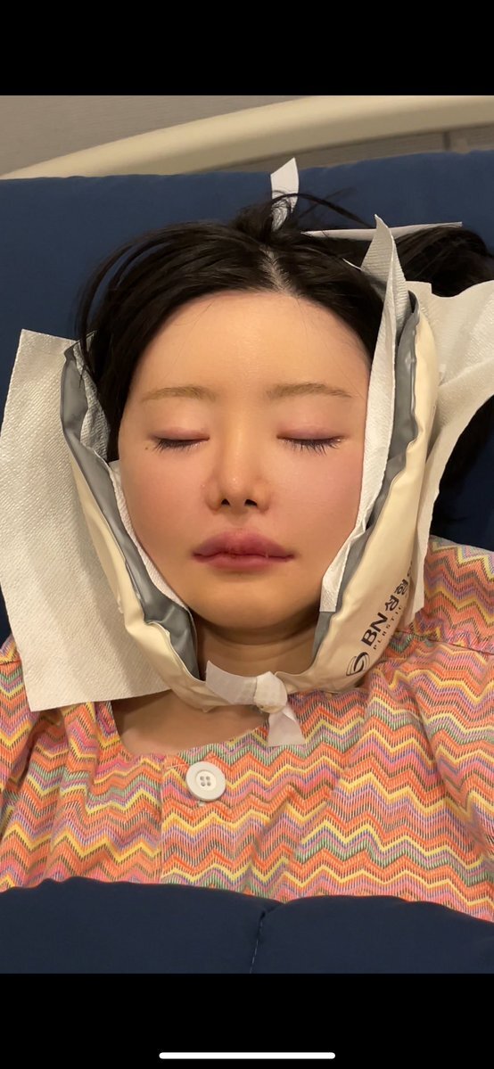 全身麻酔前に飲食しないことの重要性を示す動画が話題に