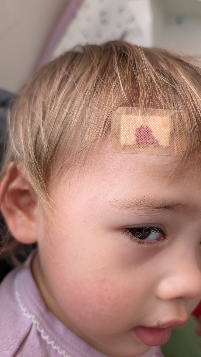 坂田さん、胃カメラ検査は麻酔なしで